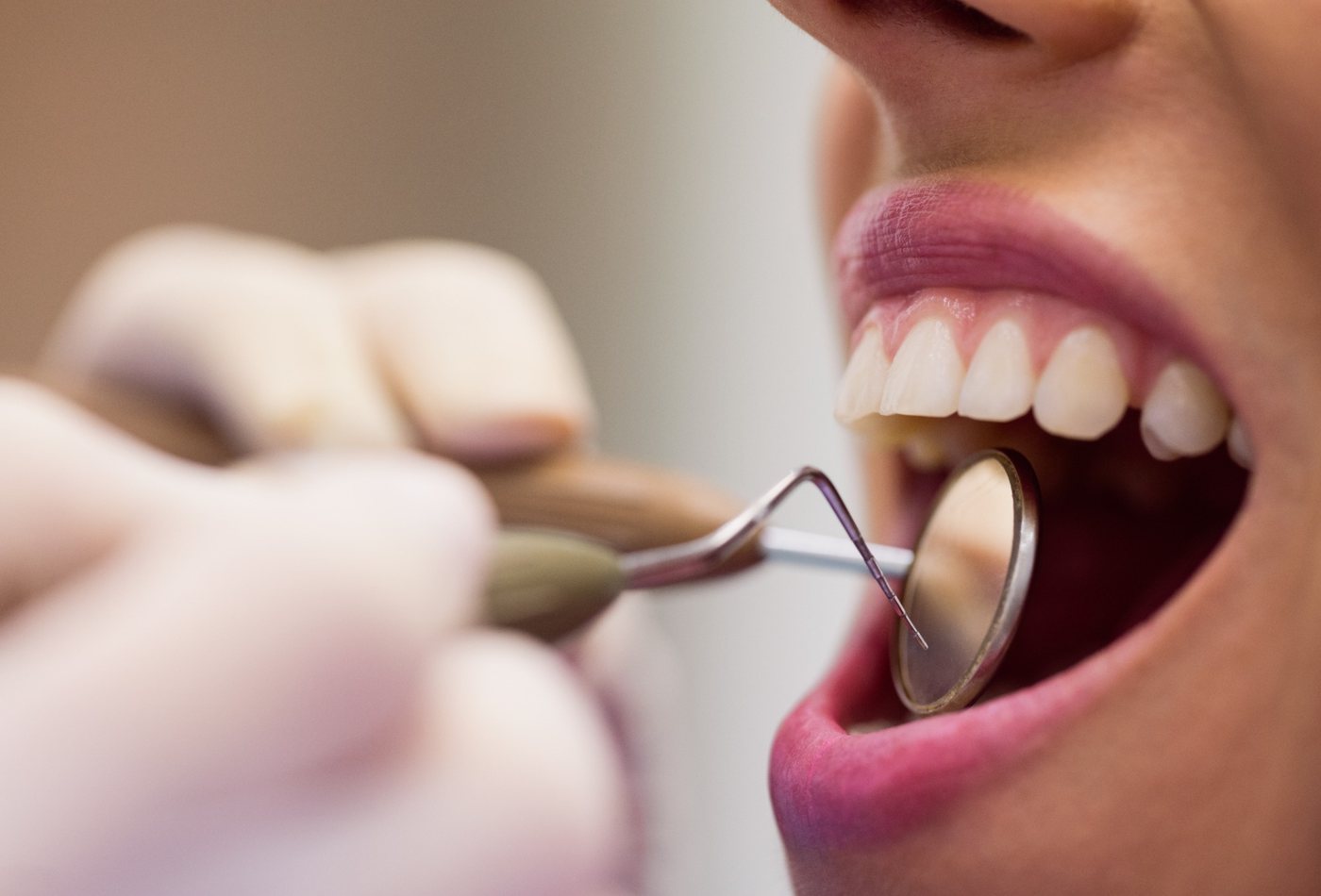 Igiene Dentale - Studio Dentistico Ferrara